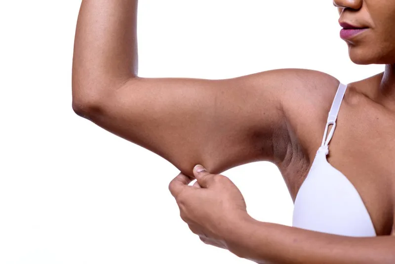 Sagging Skin concern reference
