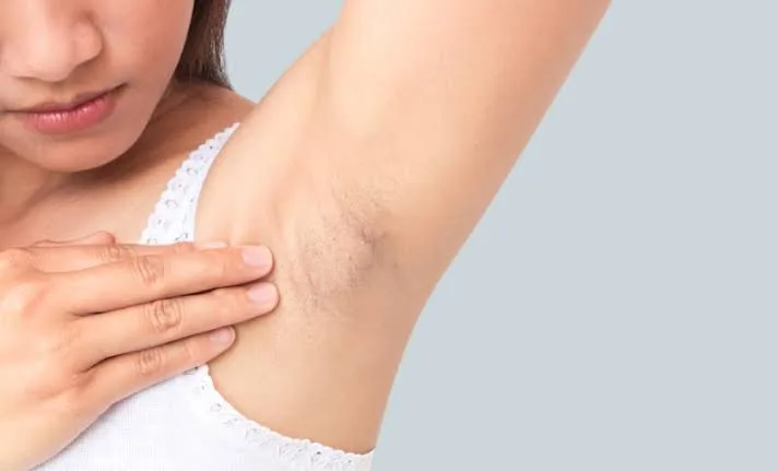 Unwanted Hair concern reference