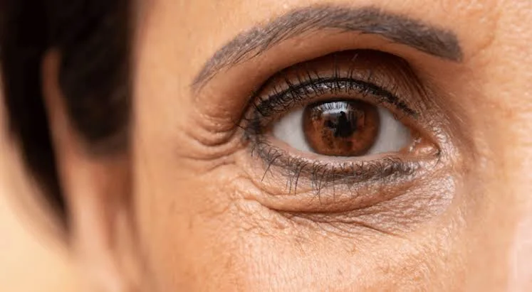 Under-Eye Rejuvenation concern reference