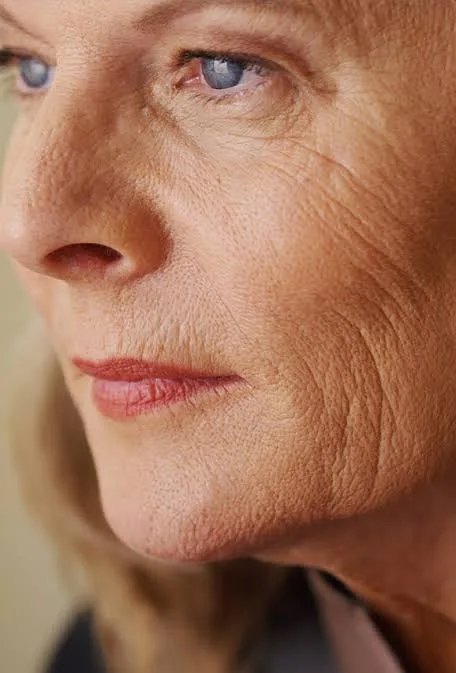 Skin Laxity concern reference