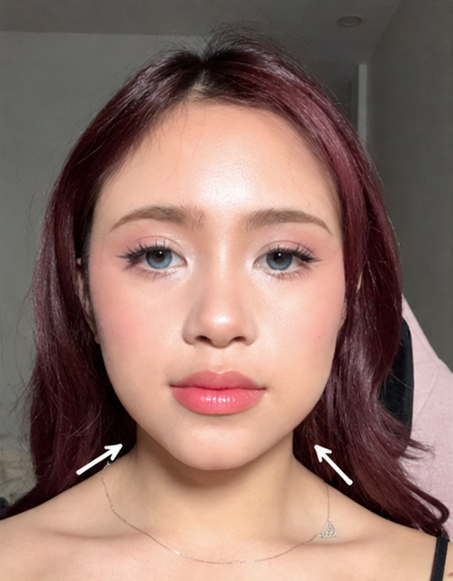 After Jawtox, full face; AI-enhanced preview
