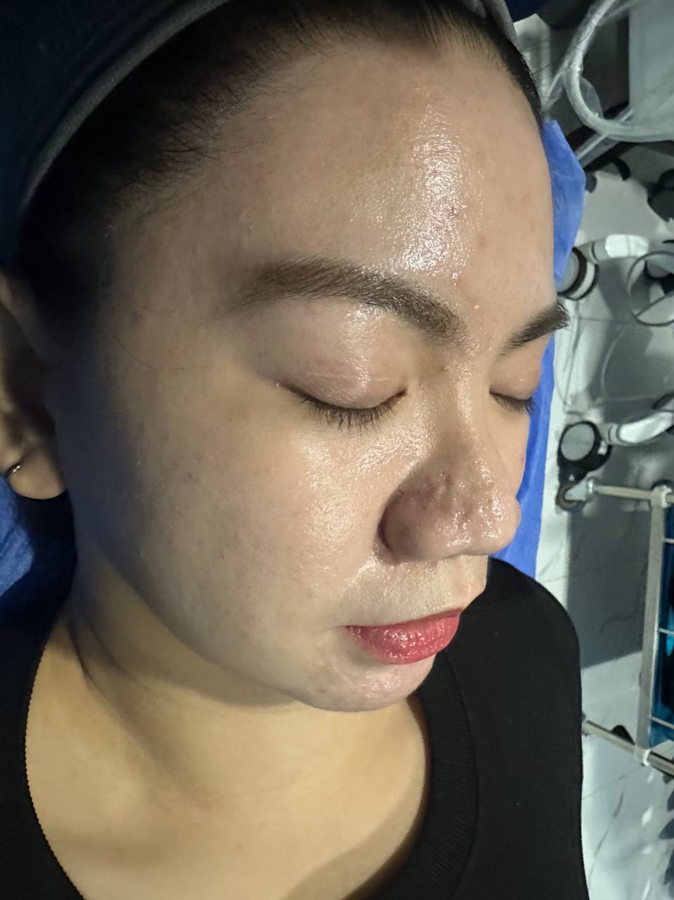 After: supplied face photograph