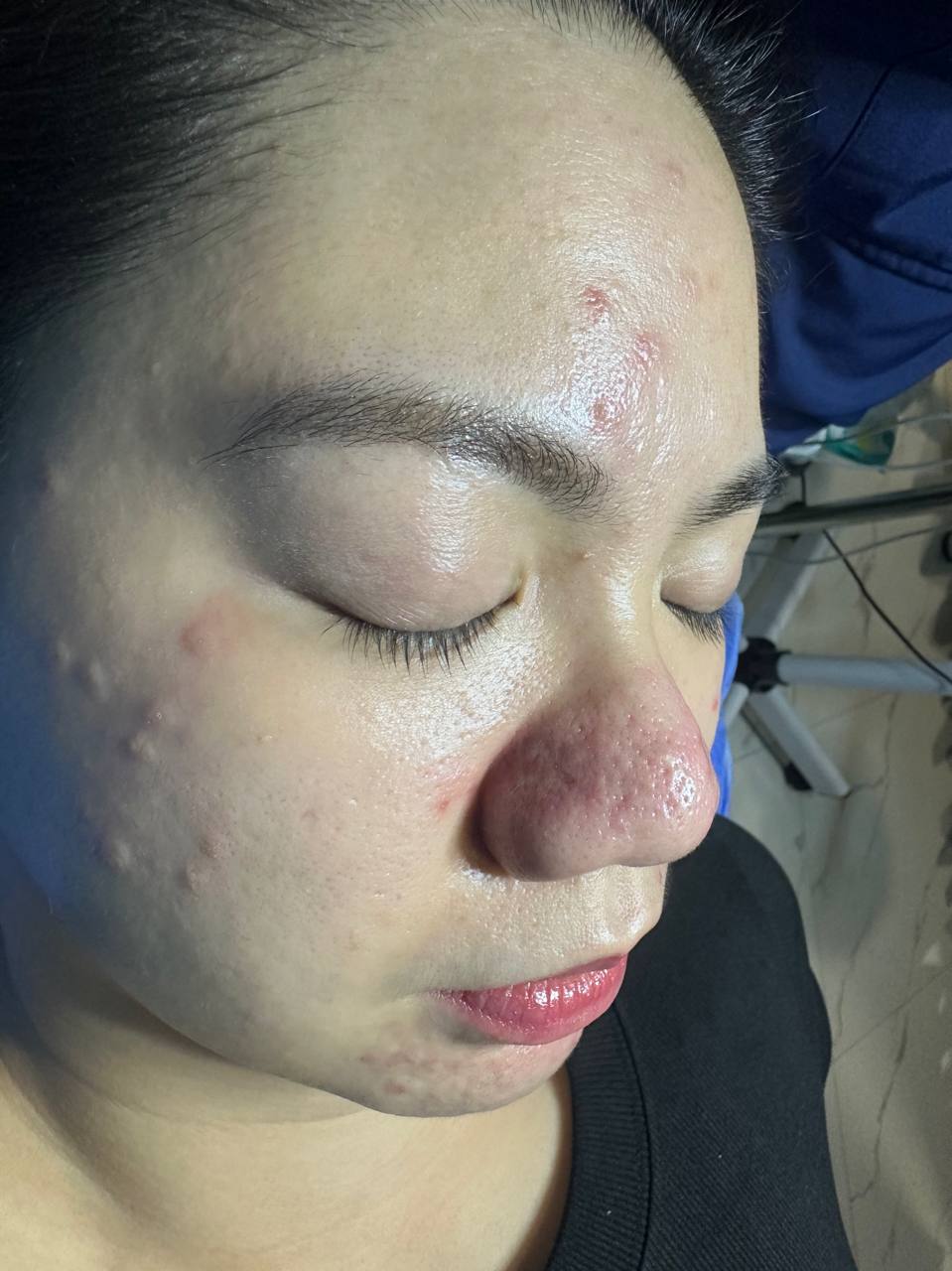 Before: supplied face photograph